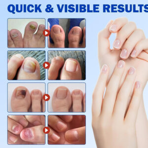 Advanced Fungal Nail Patch Treatment Powerful Antifungal Solution | Targets Nail Fungus at the Root | Easy-to-Use Patch for Toenail & Fingernail | 20 Patches